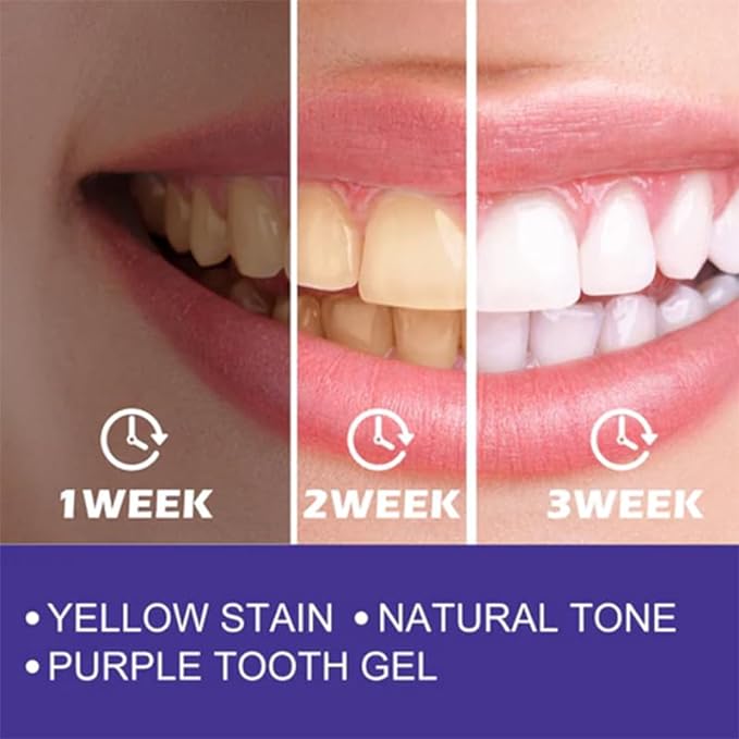 🔥 Purple Toothpaste ORIGINAL EELHOLE™ White & Shine smile 50ml